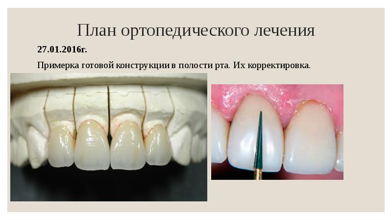 История болезни в стоматологии образец