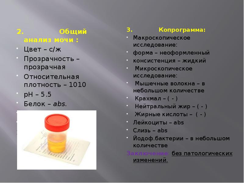 Анализ мочи картинки для презентации