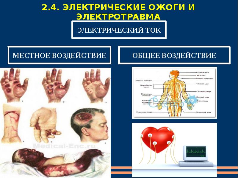 Виды травм картинки