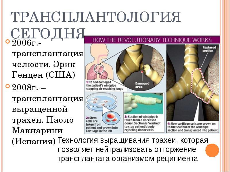 Этические проблемы трансплантологии и ксенотрансплантации презентация