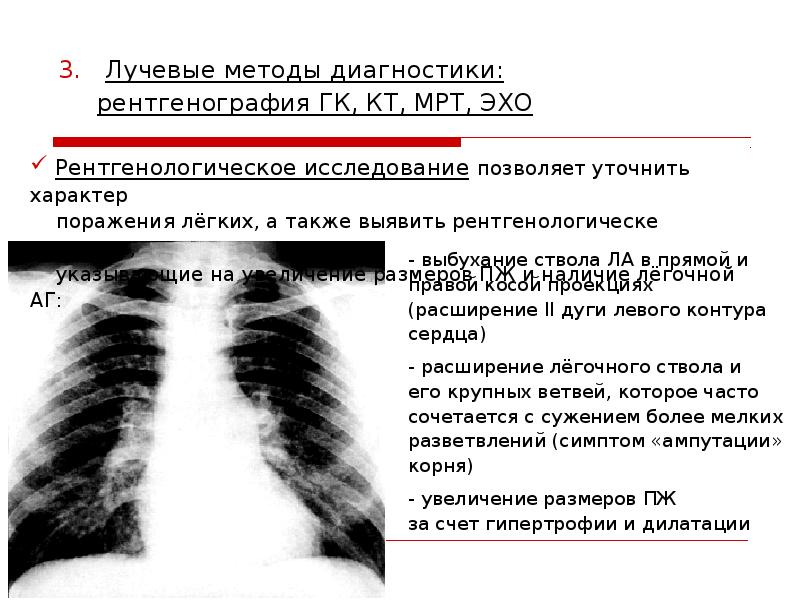 легочное расширение