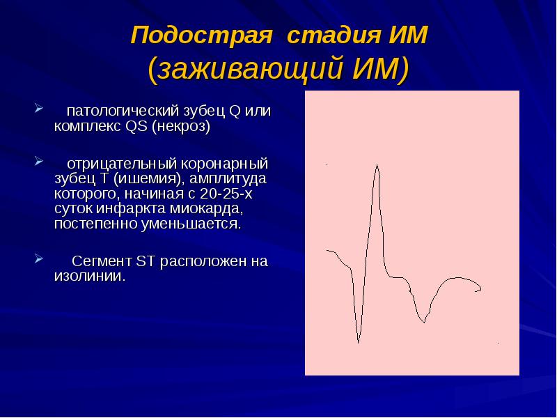 Для патологического зубца q характерно. Подострпя стаия инфар4та. Подострая стадия инфаркта. Подострый период инфаркта миокарда. Патологический зубец q.