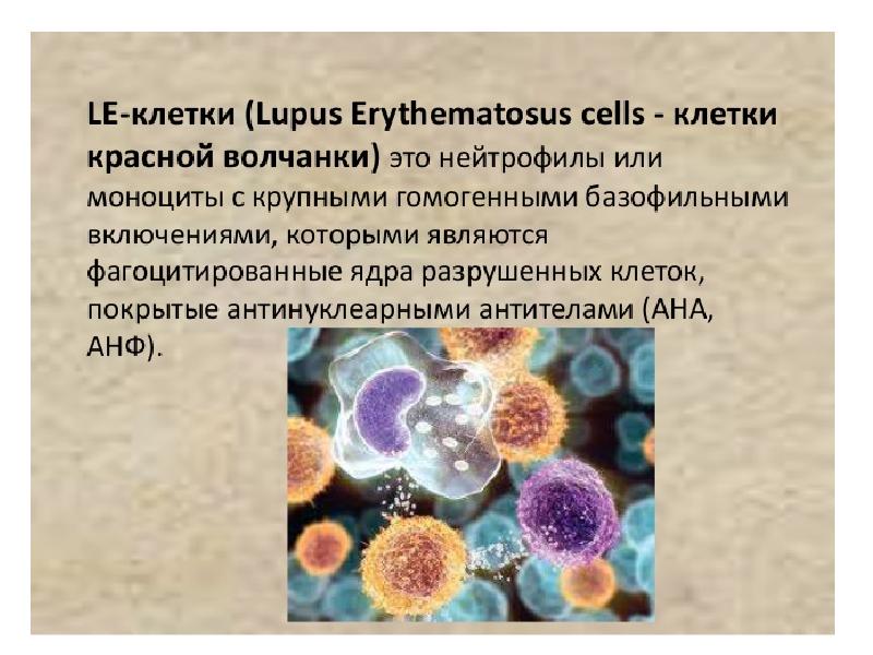 Аутоиммунные заболевания крови презентация