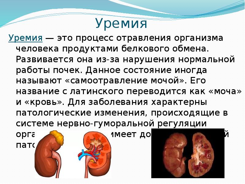 Уремия
Уремия — это процесс отравления организма человека продуктами белкового обмена. Уремия
Уремия — это процесс отравления организма человека продуктами белкового обмена.