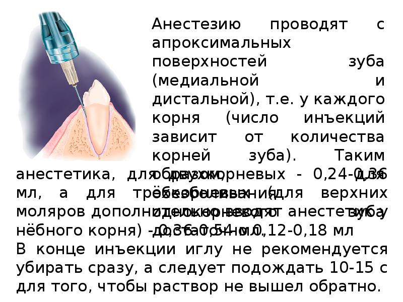 Методы обезболивания при лечении зубов презентации