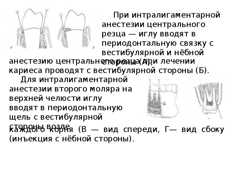 Методы обезболивания при лечении зубов презентации