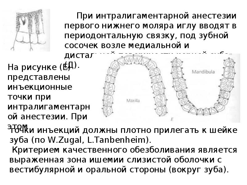 Методы обезболивания при лечении зубов презентации