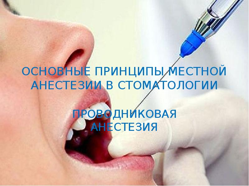 Методы обезболивания при лечении зубов презентации thumbnail