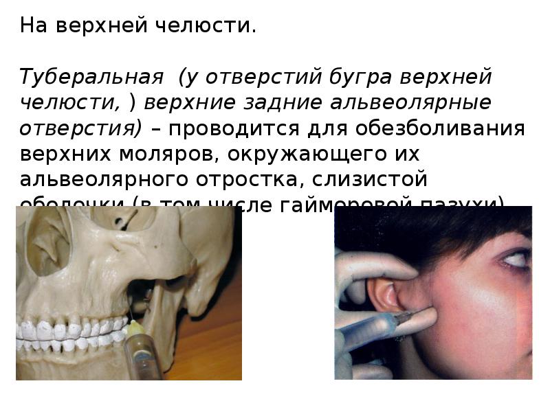 Методы обезболивания при лечении зубов презентации