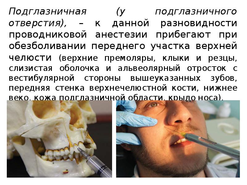 Методы обезболивания при лечении зубов презентации