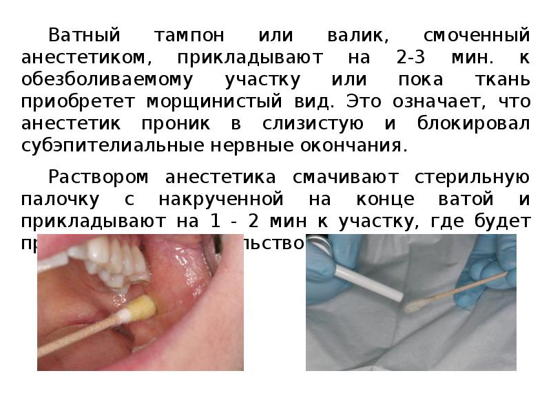 Методы обезболивания при лечении зубов презентации