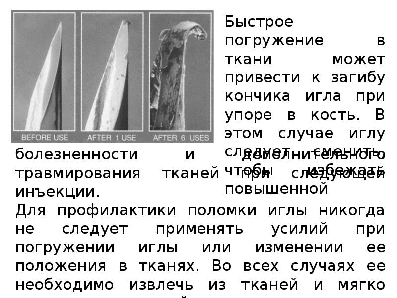 Методы обезболивания при лечении зубов презентации