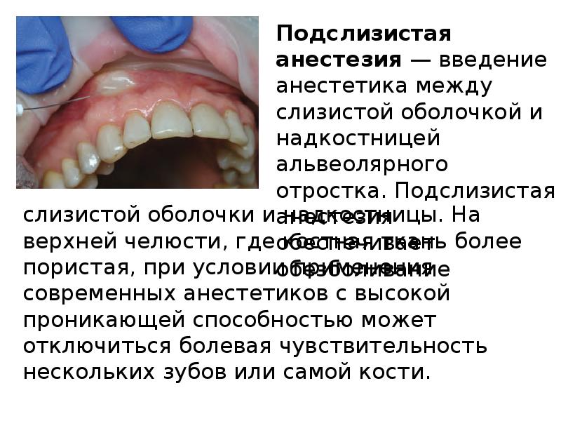 Методы обезболивания при лечении зубов презентации