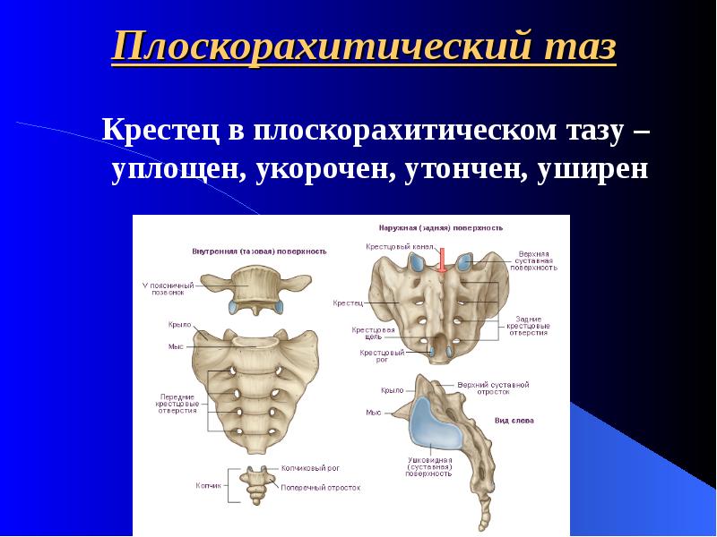 Положение крестца. Крестец и таз. Крестец анатомия. Крестец мужской и женский. Крестец у человека.