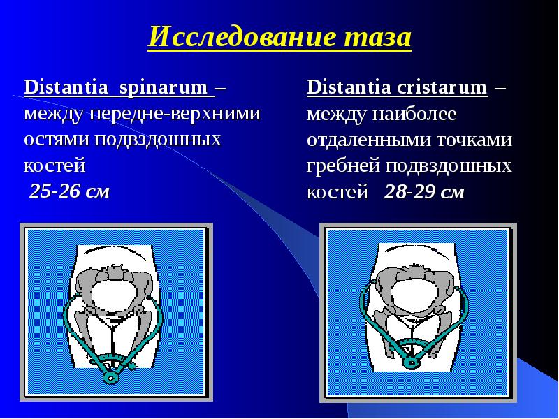 Алгоритм таз. Алгоритм таз