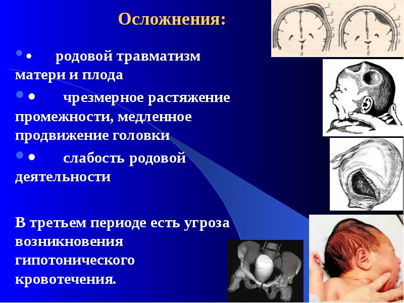 Родовой травматизм матери и плода презентация