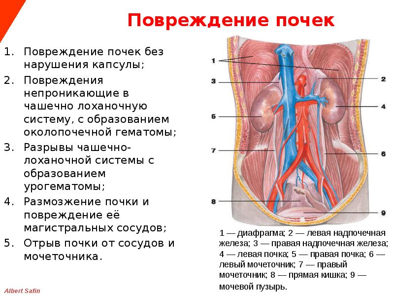 Травмы почек презентация