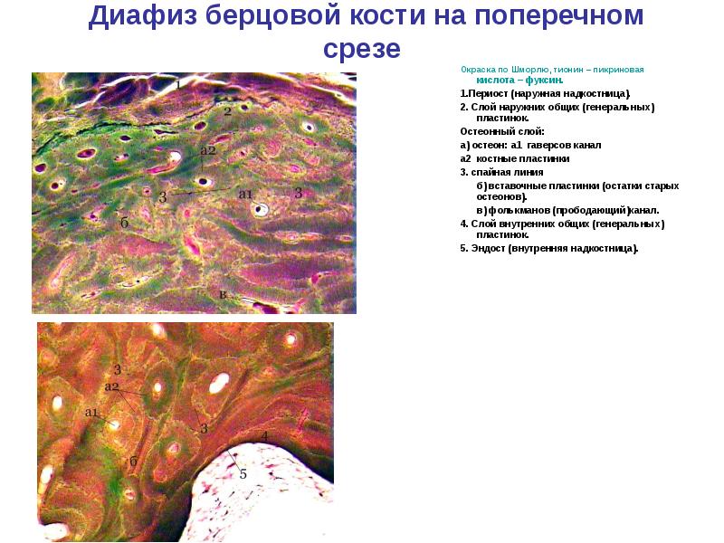 Окраска по шморлю