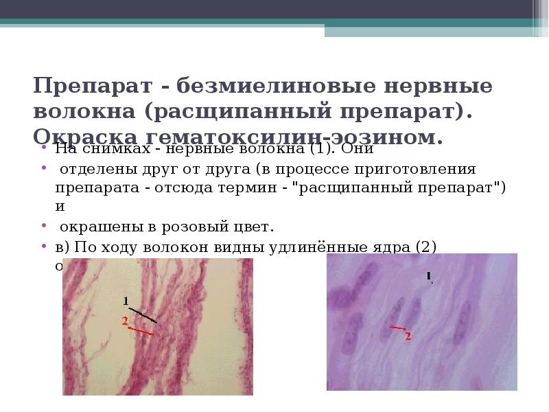 Безмиелиновые нервные волокна гистология рисунок