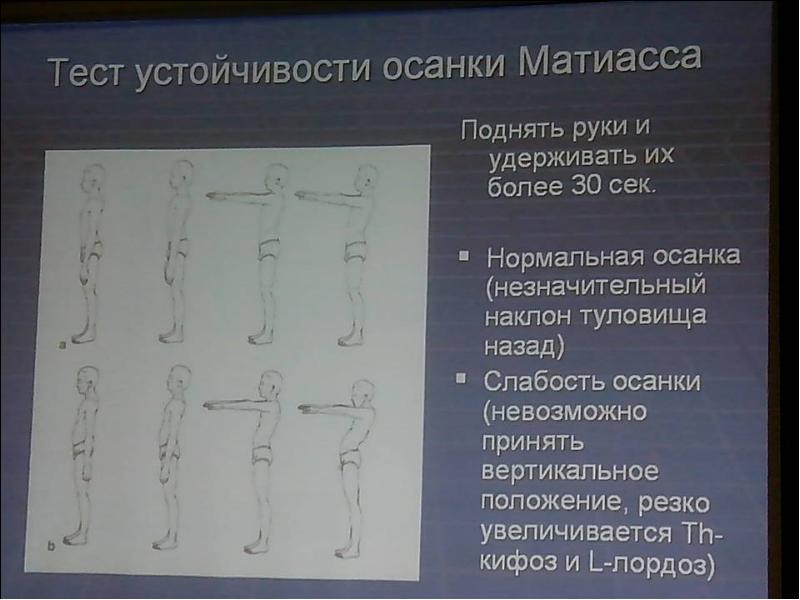 Мышцы осанки. Тестирование на устойчивость. Устойчивость осанка. Тест на устойчивость. Тест Матиаса на осанку.