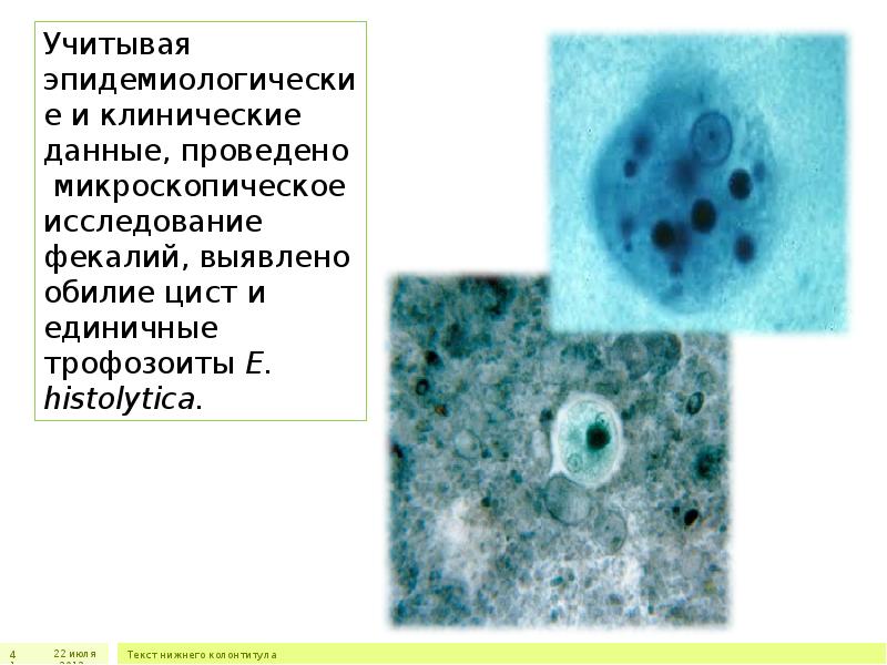 Дизентерийная амеба тип