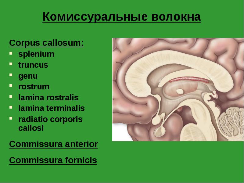 Комиссуральные волокна
Corpus callosum:
splenium
truncus
genu
rostrum
lamina rostralis
Комиссуральные волокна
Corpus callosum:
splenium
truncus
genu
rostrum
lamina rostralis