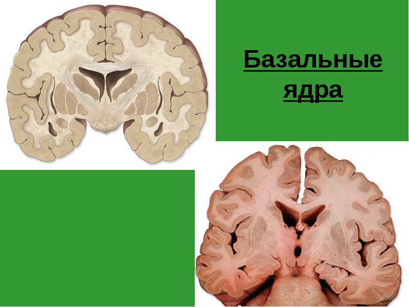 Базальные ядра Базальные ядра
