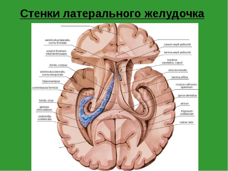 Стенки латерального желудочка Стенки латерального желудочка