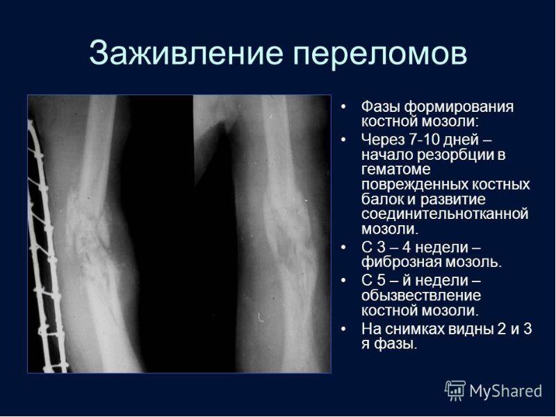 Лучевая диагностика презентация