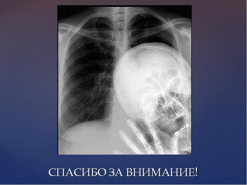 Внимания легких. Спасибо за внимание рентген. Спасибо за внимание рентгенология. Благодарю за внимание рентген.