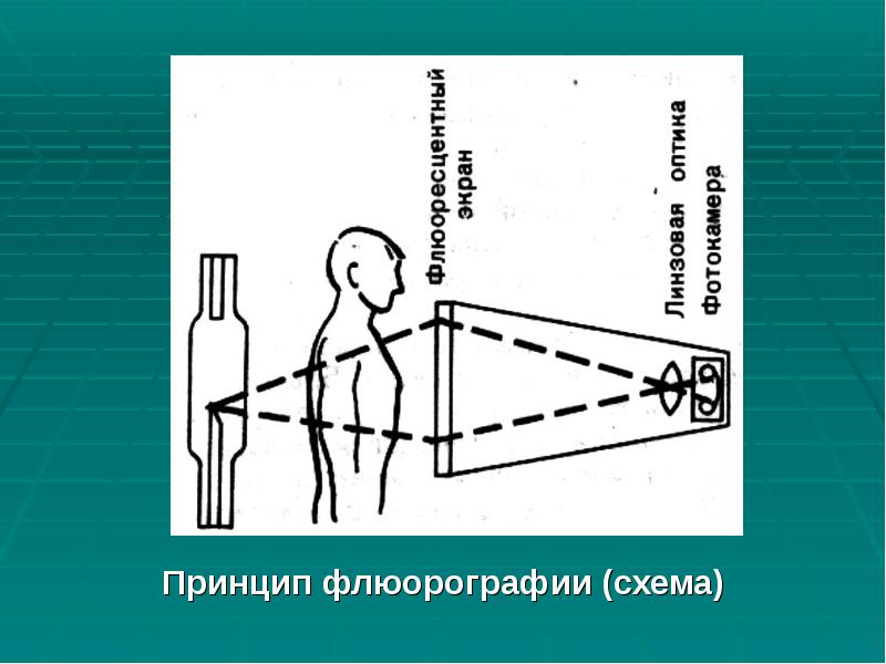 Принцип флюорографии (схема)
Принцип флюорографии (схема) Принцип флюорографии (схема)
Принцип флюорографии (схема)
