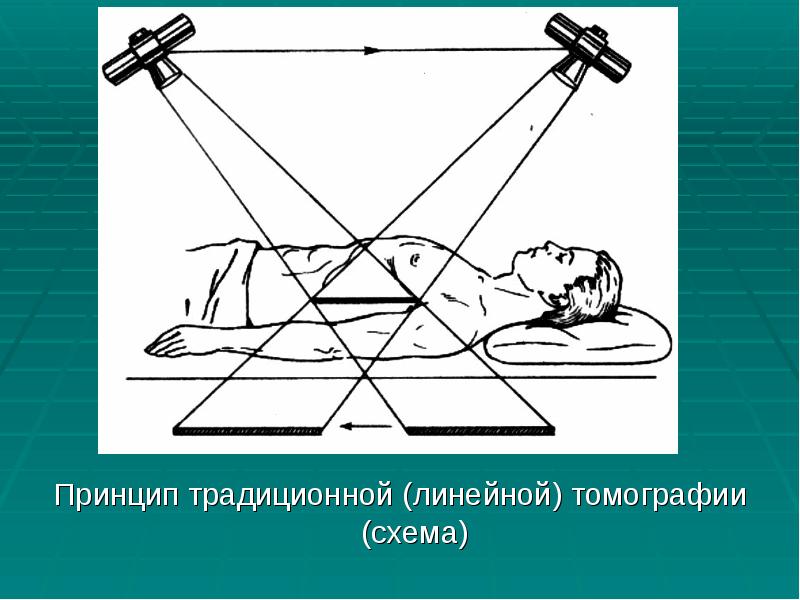 Введение в лучевую диагностику презентация