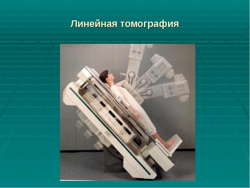 Линейная томография Линейная томография