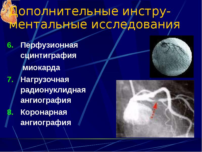 Презентация ишемическая болезнь