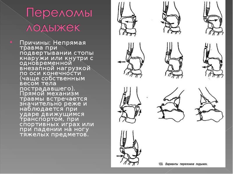 Травмы верхних и нижних конечностей презентация