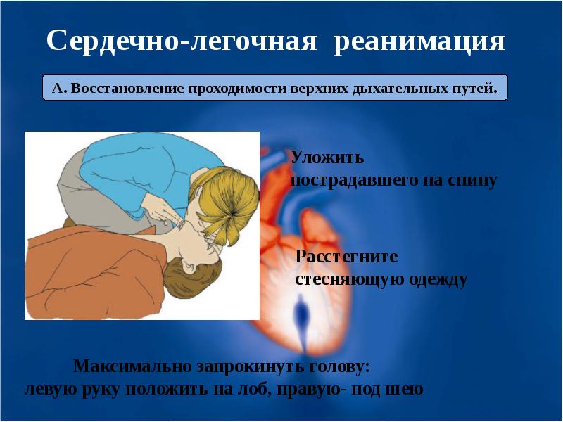 Реанимация картинки для презентации