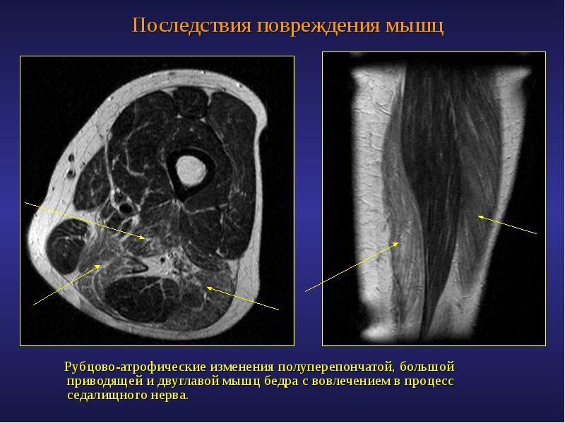 Опухоли костей и мягких тканей презентация