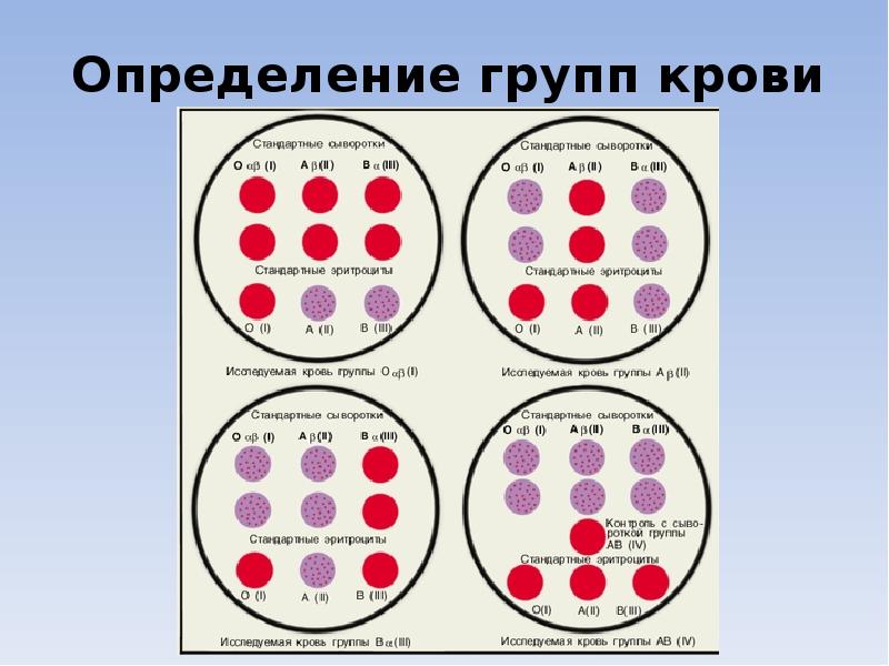 Переливание крови группы крови презентация