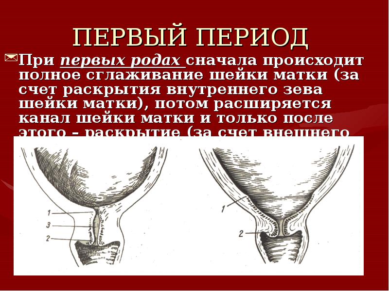 Шейка матки сколько. Шейка матки раскрытие внутреннего зева. Шейка матки наружный и внутренний зев. Наружный зев шейки матки.