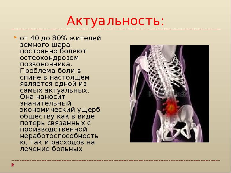 Боль в спине презентация