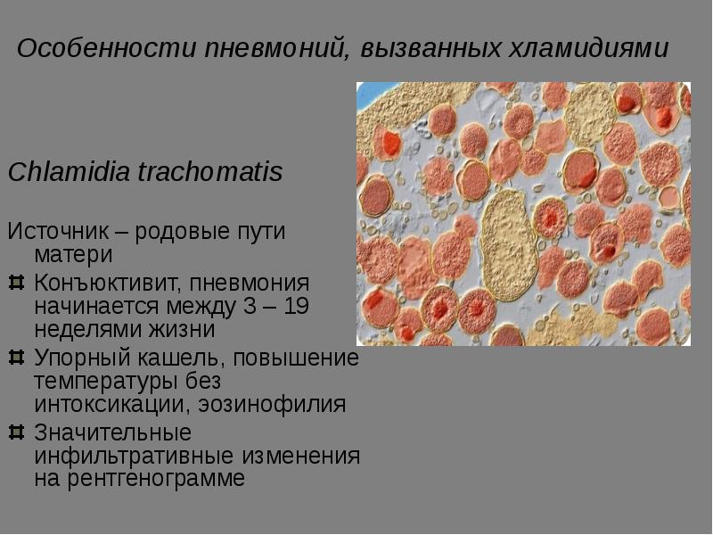 Патогенез пневмонии схема