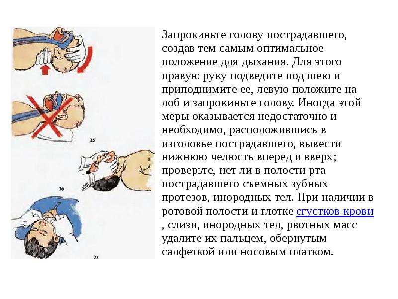 Презентация оказание первой медицинской помощи при дтп