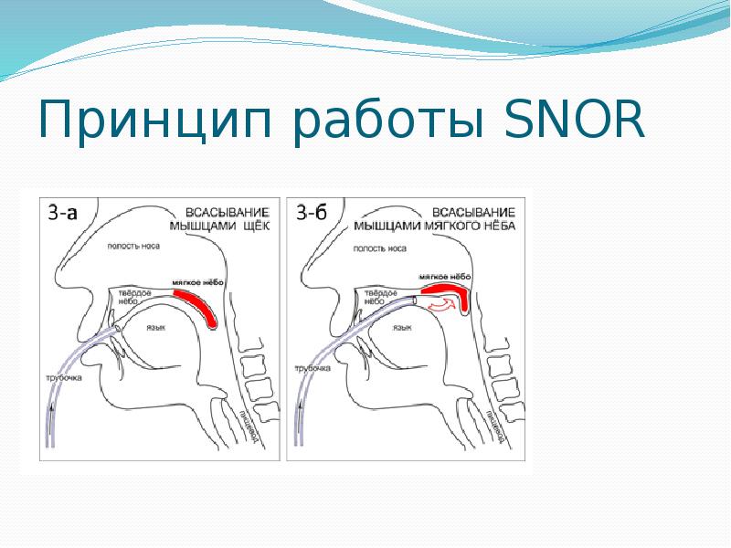 Тейпирование от храпа схема и описание