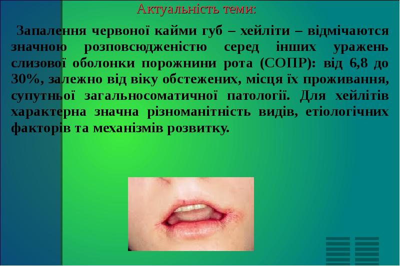 Актуальність теми: