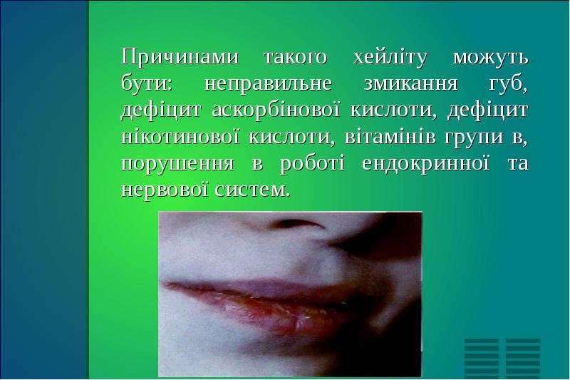 Причинами такого хейліту можуть бути: неправильне змикання губ, дефіцит аскорбінової кислоти,