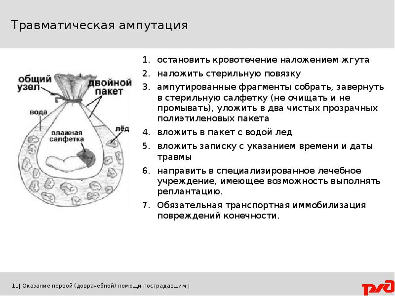 Травматическая ампутация голени карта вызова