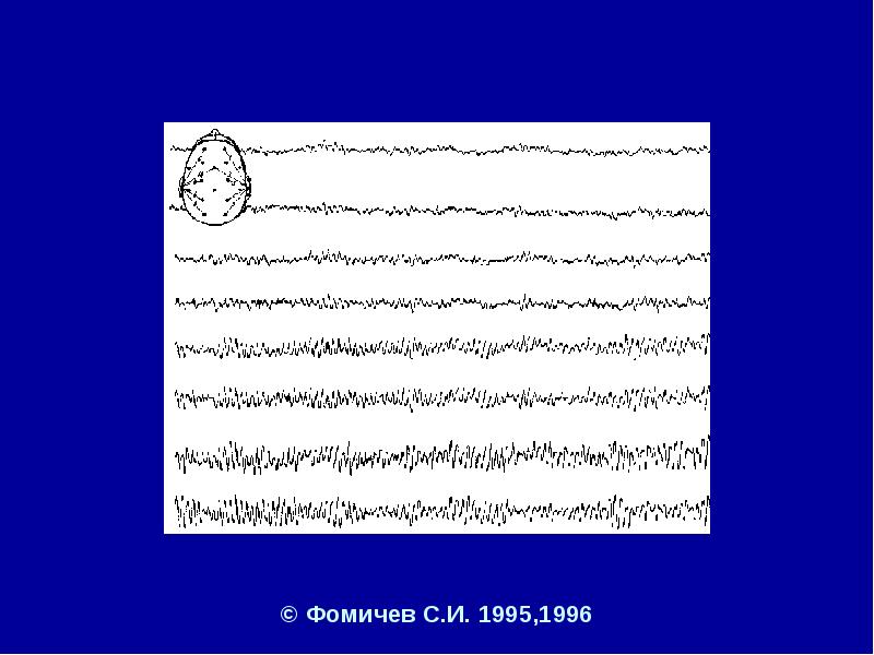 © Фомичев С.И. 1995,1996