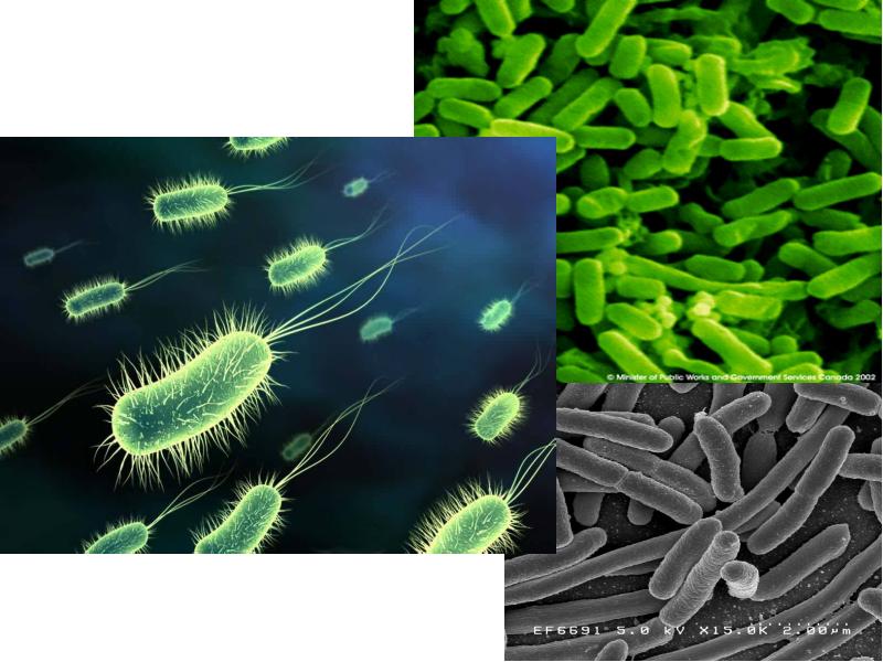 Anaerococcus spp. Anaerococcus spp