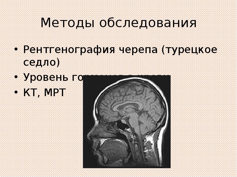 Афо эндокринной системы у детей презентация