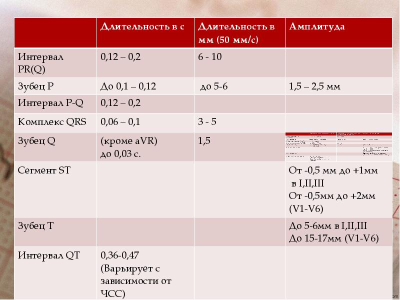 Амплитуда 4 и 1. Амплитуды зубцов ЭКГ В норме. Продолжительность зубца р в норме. Продолжительность зубцов и интервалов. Амплитуда продолжительности зубца р.